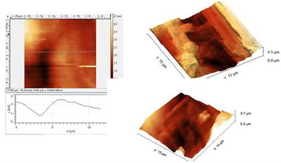 Endothelial Injury in Diving: Atomic Force-, Electronic-, and Light-Microscopy Study of the Ovine Decompressed Blood Vessels